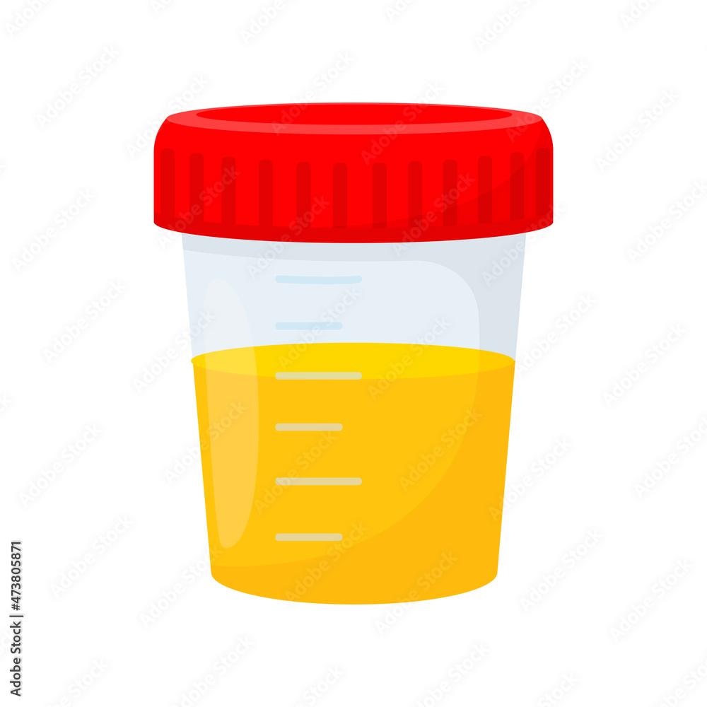 Analysis of urine. Plastic container for urine sample isolated on white ...