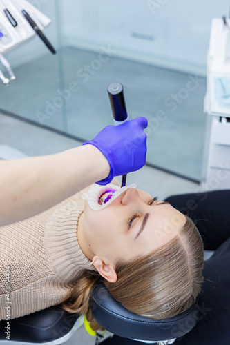 A woman's teeth with metal braces are being treated at the clinic. An orthodontist uses dental instruments to place braces on a patient's teeth. Selective focus