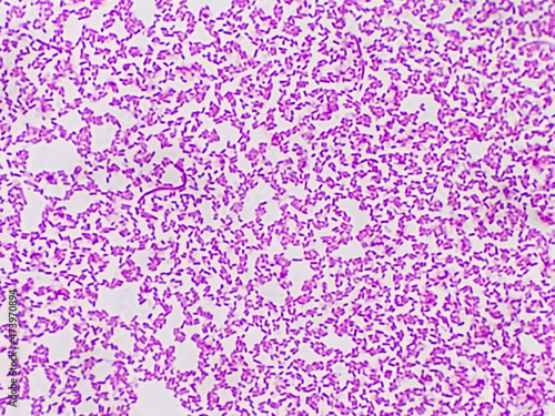 Fotografie Blood culture colonies gram stained microscopic 100x show Salmonella Typhi (S