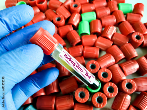 Blood sample tube for Marburg Virus test photo