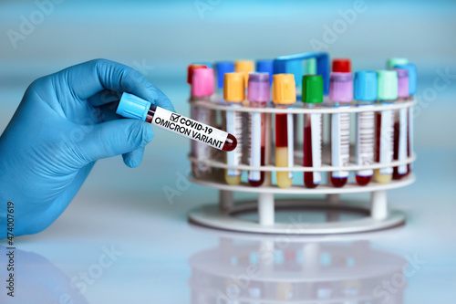 Doctor's hand holding blood sample tube of New Variant of Covid-19 called Omicron B.1.1.529. Researcher in lab holding sample of new strain of Coronavirus Mutations Omicron photo