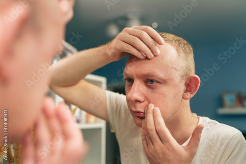 Man try putting on contact lenses in eye front bathroom mirror. Optic health treatment. Ophthalmology and eyes care concept