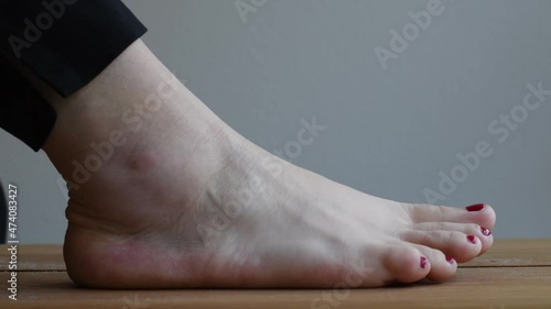 Person with a sprained ankle grabbing bandage roll to wrap around the swollen foot. 