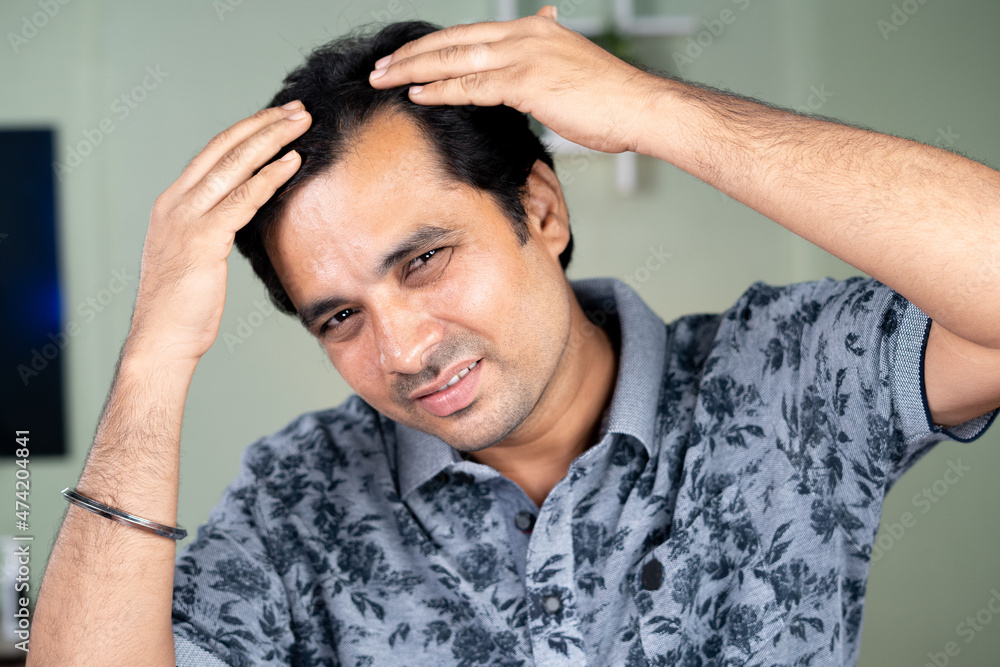 Worried Young man checking white hairs or Hair loss by looking Camera - concept of alopecia , Haircare and dandruff problem Worried Young man checking white hairs or Hair loss by looking Camera - concept of alopecia , Haircare and dandruff problem