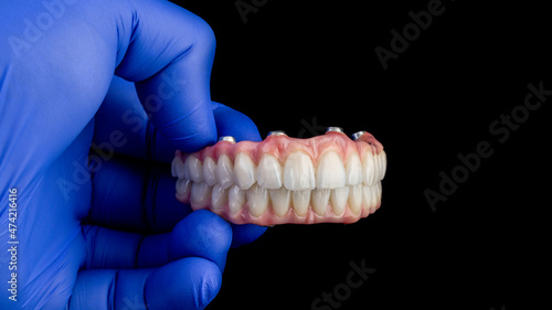 Dental implants and dentures in close-up Siemke on a black background
