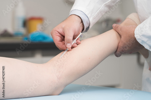 Surgery and Medical theme: Doctor performs sclerotherapy for varicose veins on the legs, varicose vein treatment, copy space, injection. photo