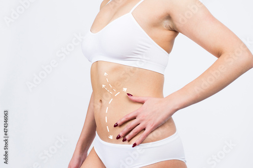 Cellulite removal on body girl. Young girl with beautiful and healthy body concept close up. © maxsim