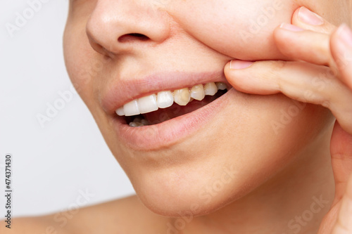 Cropped shot of a young woman showing shows yellow fangs isolated on a white background. Dark tooth enamel  contrast. Dentistry  dental care