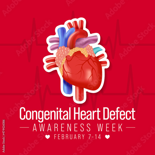Congenital Heart defect (CHD) awareness week is observed every year from February 7 to 14th, is a problem within the structure of the heart that is present at birth. Vector illustration