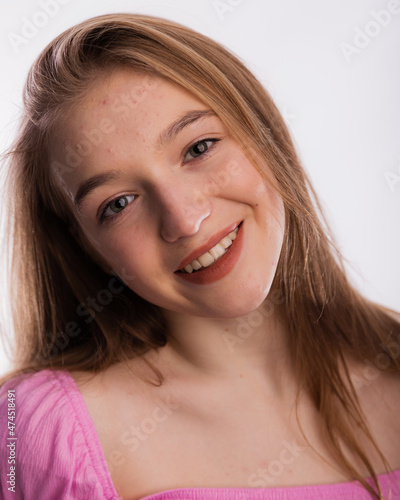 Portrait of a pimply young woman face. She is not upset and sweetly smiles on white background copy space.