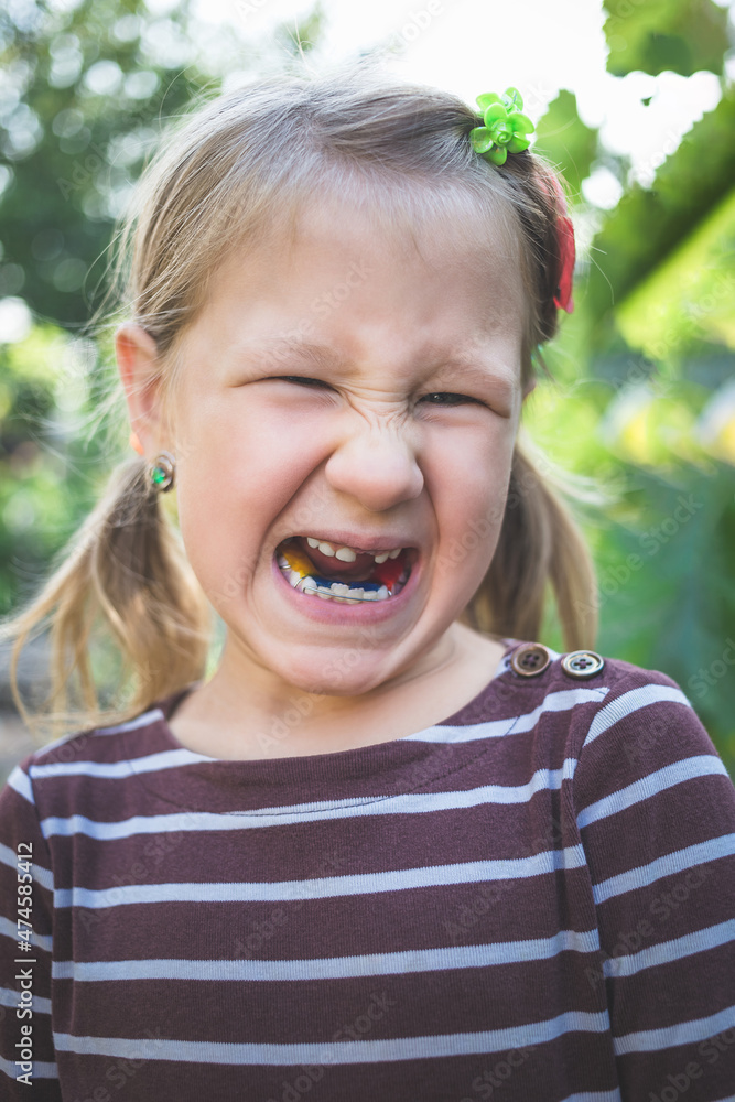 Child with a dental orthodontic device and without one tooth Child with a dental orthodontic device and without one tooth