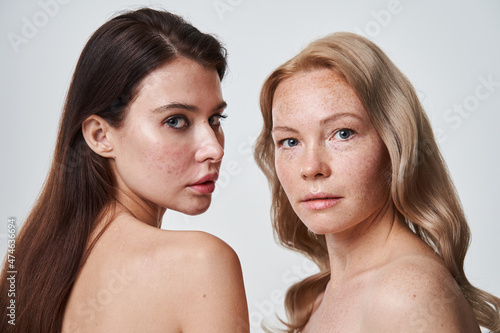 Calm diverse young women posing together, while looking at the camera