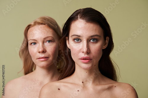 Two diverse women with naked shoulders standing behind of each other