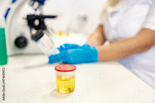 A bottle with a urine sample. Biochemistry. A bottle with a urine sample on a table in a lab. In a blurry background, a nurse analyzes samples with a microscope.