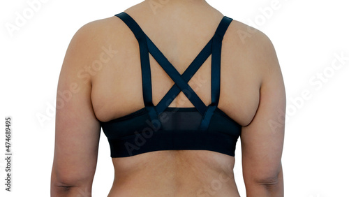 Cuadro en lienzo Close up chubby woman from back wearing wrong size of brassiere made meat folds out on back, excess weight of fat woman, small bra on fat body