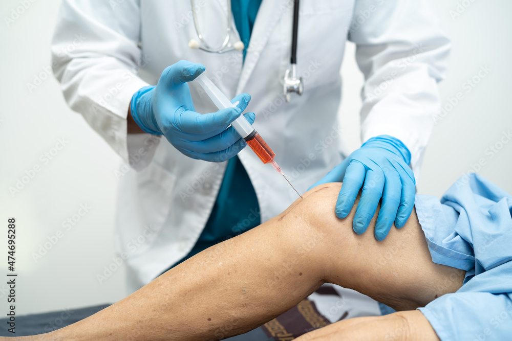 Asian doctor inject Hyaluronic acid platelet rich plasma into the knee of senior woman to walk without pain. Asian doctor inject Hyaluronic acid platelet rich plasma into the knee of senior woman to walk without pain.
