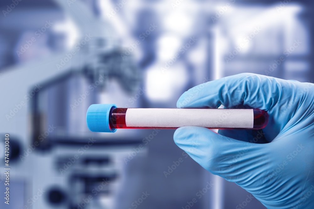 Doctor in the lab holding tubes of blood. Laboratory Technician with blood samples with a New Variant of the Coronavirus Doctor in the lab holding tubes of blood. Laboratory Technician with blood samples with a New Variant of the Coronavirus