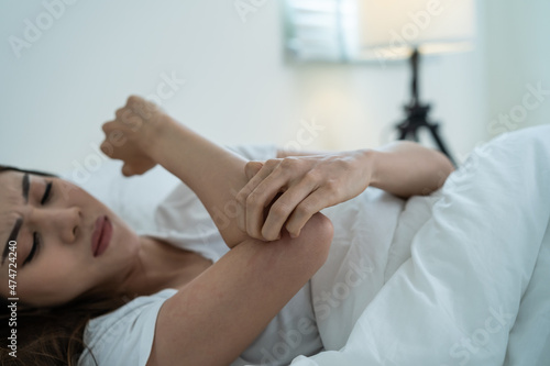 Asian young woman scratch hand feel suffer from allergy while sleeping. Beautiful attractive girl lying on bed in bedroom suffering from itching arm skin allergic reaction to insect bites, dermatitis. © Kawee