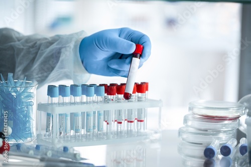 A covid-19 vaccine. Doctor's hand holds a bottle with a coronavirus vaccine photo