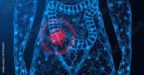 Appendicitis. Inflammation and pain in the appendix area. Polygonal construction of interconnected lines and points. Blue background.