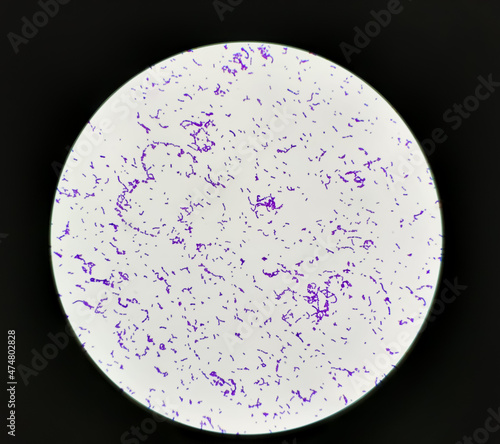 Streptococcus pyogenes infected in aged patient, showing of gram's stain from positive hemoculture. photo
