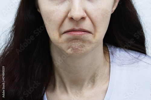 Displeased face with nasolabial folds Caucasian woman. Lowered corners of lips. photo