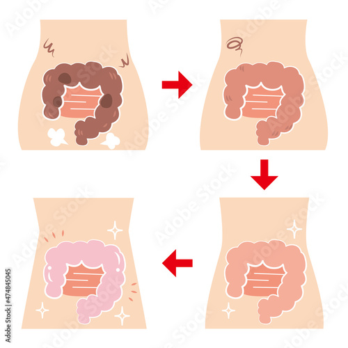 超不健康な腸からそこそこ不健康な腸、そこそこ健康な腸、超健康な腸に至るまでビフォーアフターのセット photo