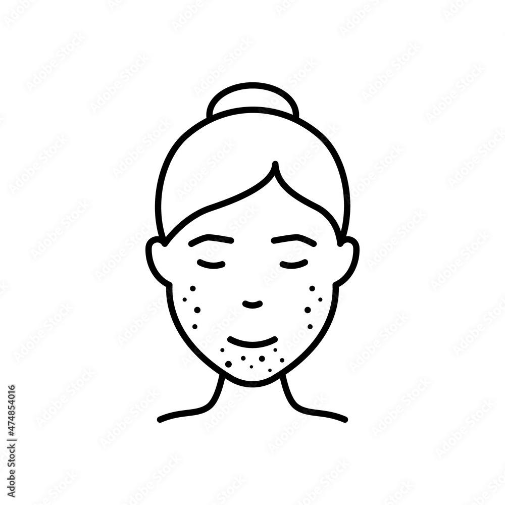 Woman with Blackhead, Acne, Rash on Face Line Icon. Girl with Pimples Face Outline Icon. Allergy, Inflammation Skin, Dermatologic Problem. Editable Stroke. Isolated Vector Illustration