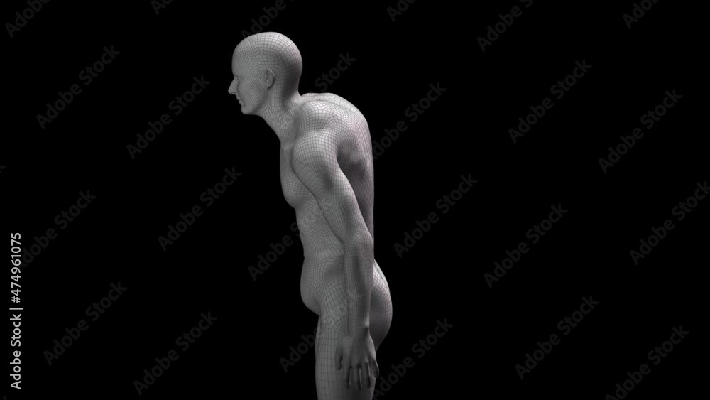 man , scoliosis, hump, osteochondrosis man , scoliosis, hump, osteochondrosis
