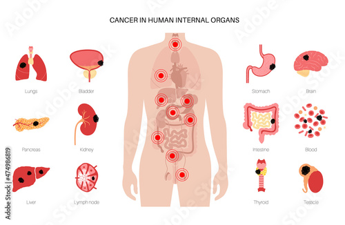 Cancer icons set