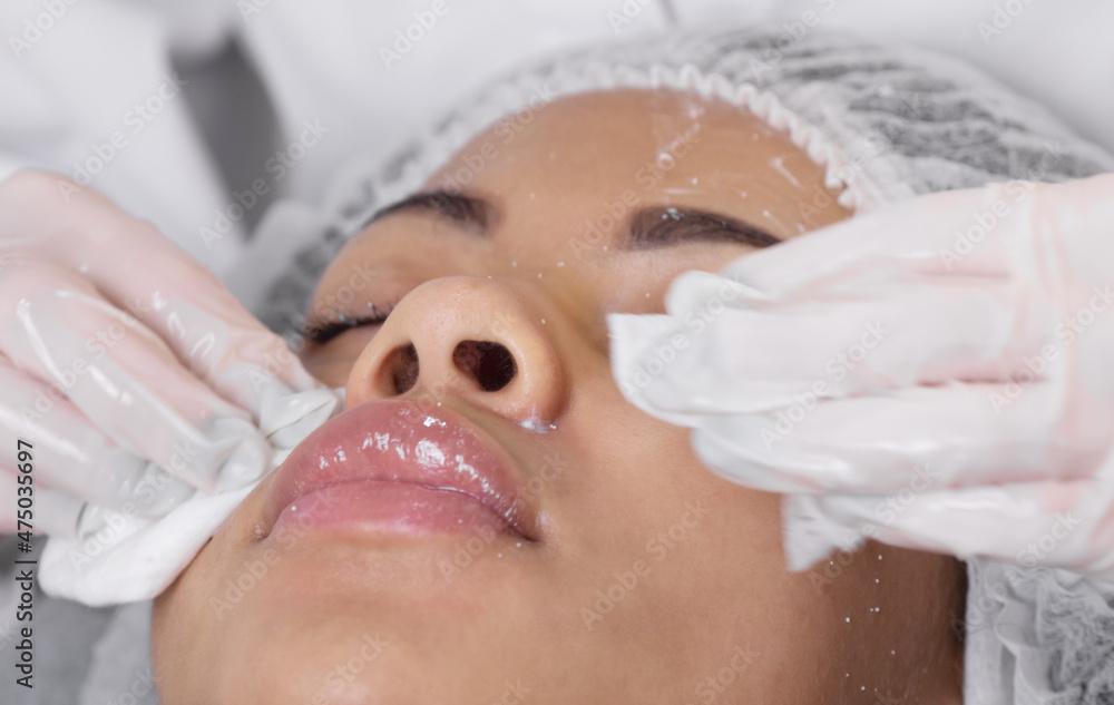 Procedure for manual cleansing of the facial skin from blackheads and acne. Beauty parlour. Procedure for manual cleansing of the facial skin from blackheads and acne. Beauty parlour.