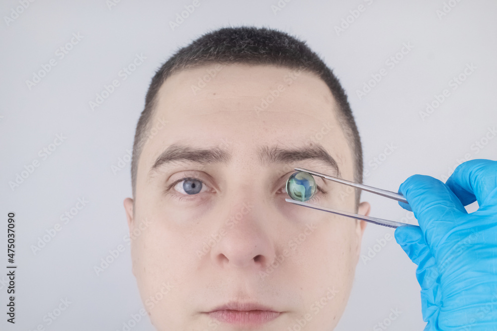 Zdjęcie Stock Conceptual shot of an eye crystalline lens replacement