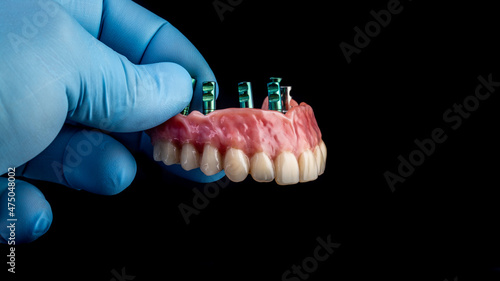 dentures on a black background, dental implants	
