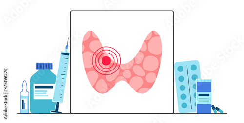 hypothyroidism thyroid gland