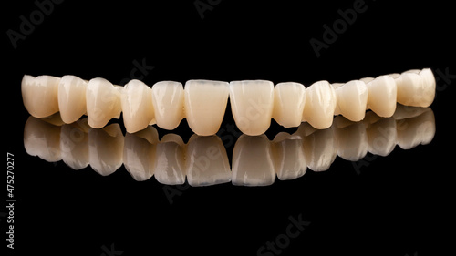 Dental implants and dentures in close-up Siemke on a black background	
