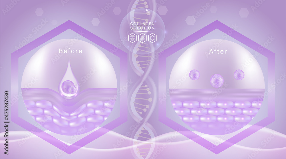 Hyaluronic acid before and after skin solutions ad, purple collagen serum drops with cosmetic advertising background ready to use, illustration vector. Hyaluronic acid before and after skin solutions ad, purple collagen serum drops with cosmetic advertising background ready to use, illustration vector.