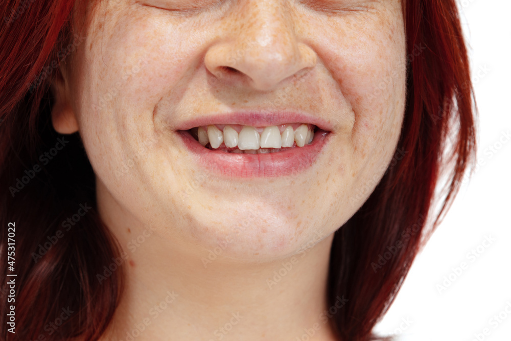 Close-up of open smiling female mouth without lips makeup. Cosmetology, medicine, dental health. Detailed. Close-up of open smiling female mouth without lips makeup. Cosmetology, medicine, dental health. Detailed.
