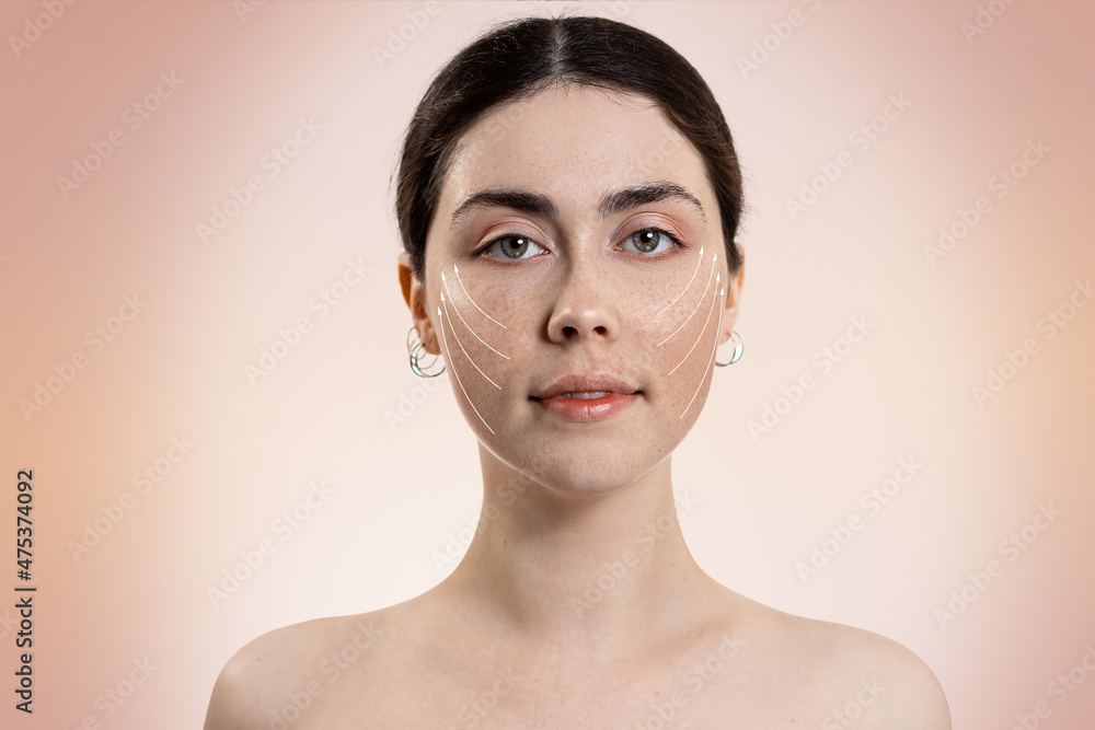 Portrait of a young beautiful woman with white arrows on her face. Beige background. Copy space. The concept of plastic surgery and rejuvenation Portrait of a young beautiful woman with white arrows on her face. Beige background. Copy space. The concept of plastic surgery and rejuvenation