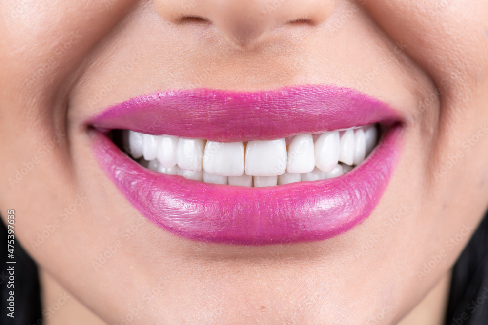 Fototapeta premium beautiful white smile with lipstics