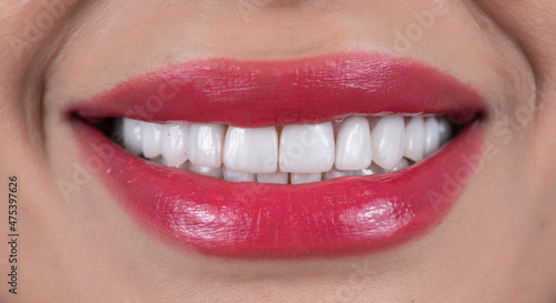 beautiful white smile with lipstics