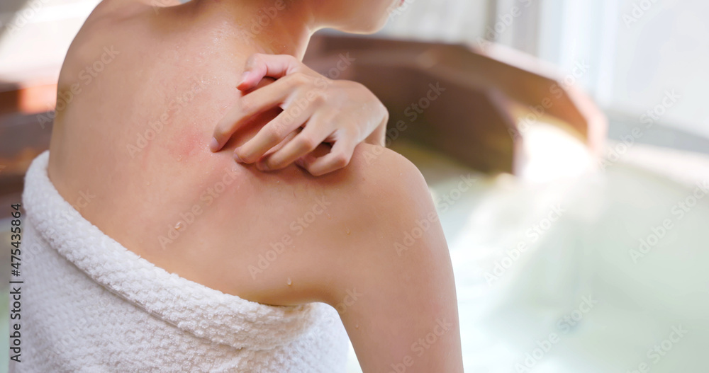 scratches shoulder in hot spring scratches shoulder in hot spring