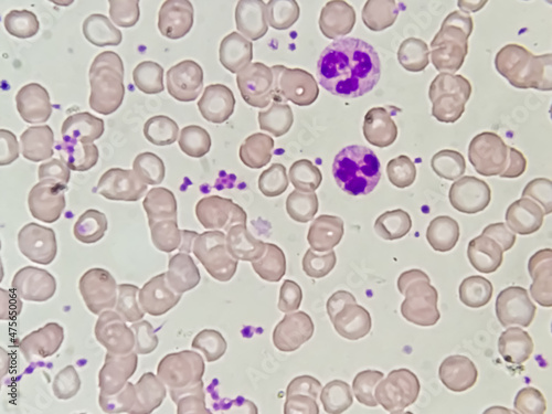 Blood smear microscopic show platelet, neutrophil, red blood cell and polychromatic in the peripheral blood of cat with regenerative anemia.