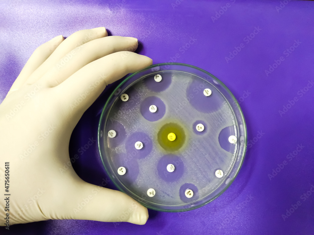 Antimicrobial susceptibility testing in petri dish. Antibiotic