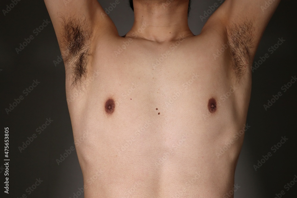 わき毛を片側だけ脱毛した日本人男性 わき毛を片側だけ脱毛した日本人男性