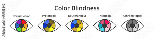 Vector set of icons or symbols of eyes with color blindness or colorblindness isolated on white. Normal vision, protanopia, tritanopia, deuteranopia, achromatopsia. Decreased ability to see colors. photo