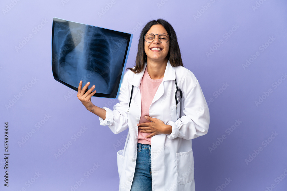 Young doctor woman holding a radiography smiling a lot Young doctor woman holding a radiography smiling a lot