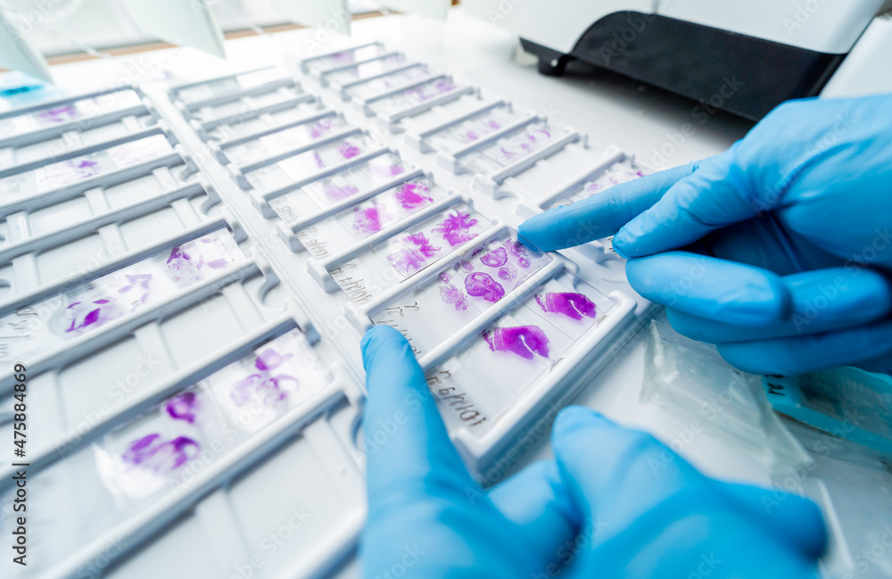 Hand in blue glove holding glass histology slides Hand in blue glove holding glass histology slides