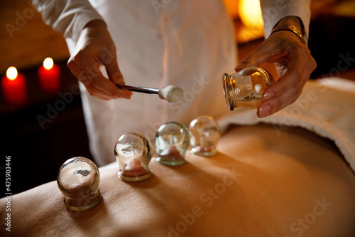 A young woman relaxes in a massage parlor. Vacuum cups of medical cupping therapy on woman back, close up, chinese medicine.