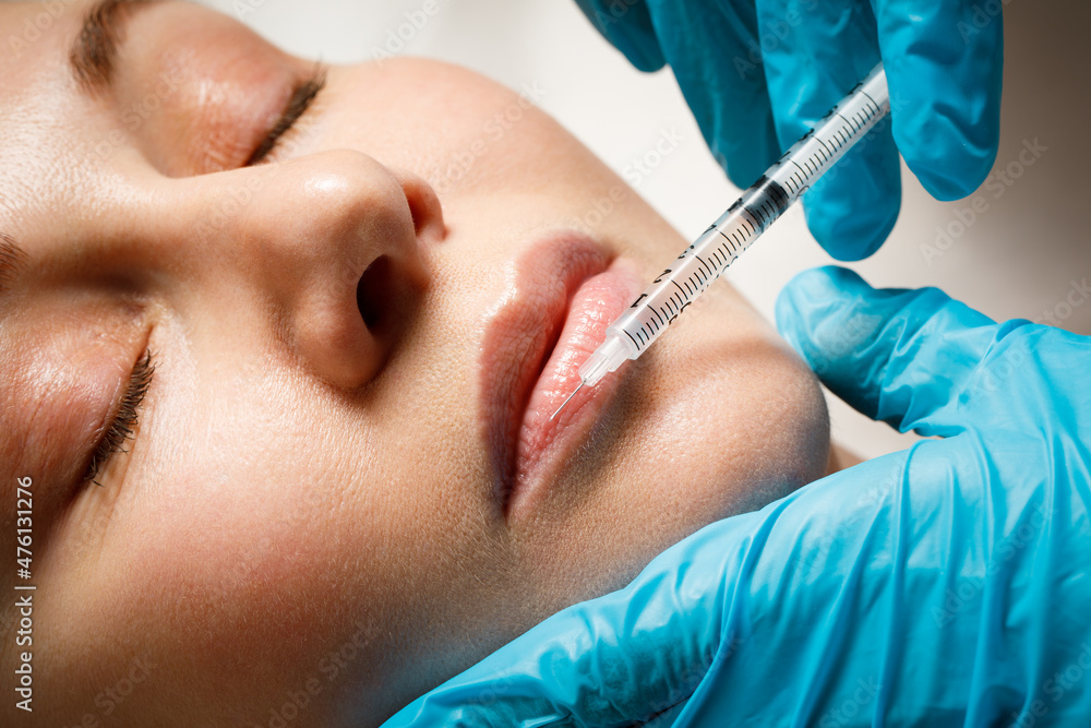A woman makes lip shape correction in a cosmetology clinic. Lips injections, lip augmentation. A woman makes lip shape correction in a cosmetology clinic. Lips injections, lip augmentation.