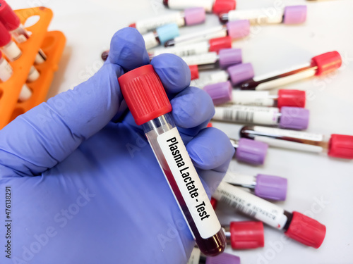 Test tube with blood sample for Plasma lactate test, Lactic acid test, laboratory background photo